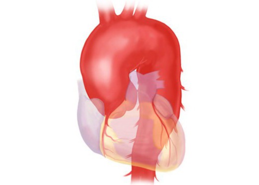 anatomia da aorta 