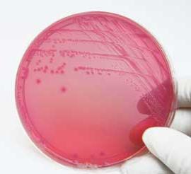 Escherichia coli em um esfregaço