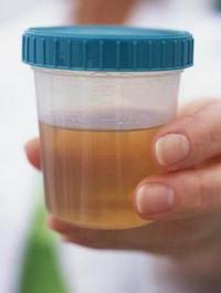Se uma proteína na urina for encontrada, o que isso significa?