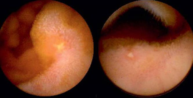 onde fazer endoscopia capsular 