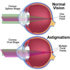 lentes de contato toric 