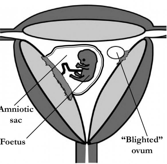 anexo do ovo fetal