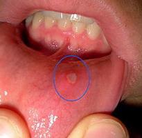 Membrana mucosa - uma barreira única do nosso corpo