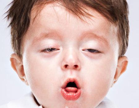 tosse seca em crianças sem febre: Causas e Tratamento