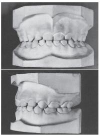 A fórmula dental humana. O que significa e quais tipos de fórmulas existem?